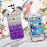 3D Glitter Mickey Mouse Ears Soft TPU Case for iPhone 7